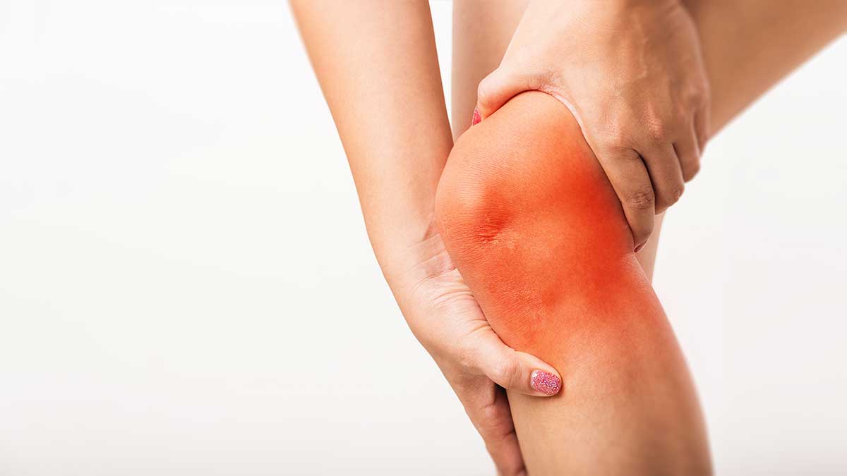 ひざが腫れて熱を持つ時にできる、5つの応急処置【整形外科医執筆】